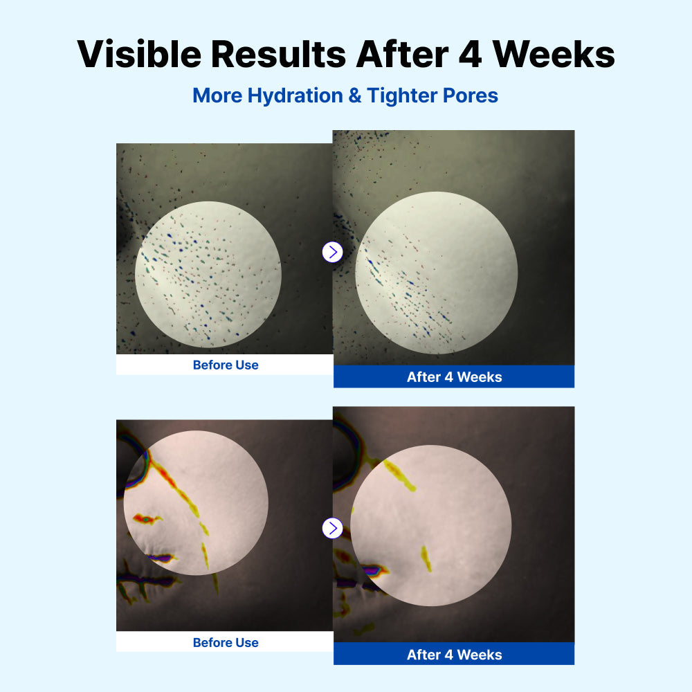 NIDA Youthful Formula crema hidratante beneficios piel