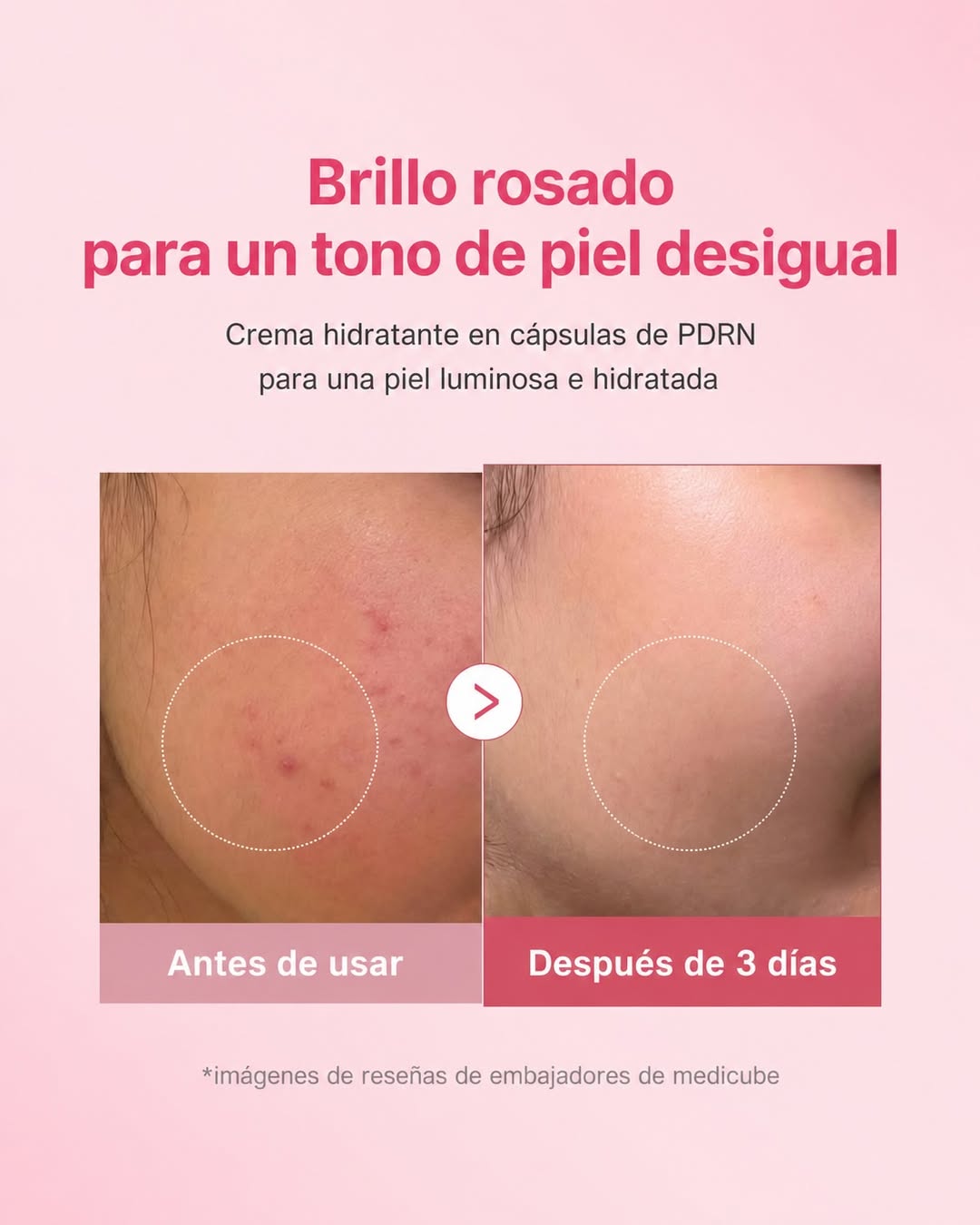 Medicube PDRN Pink Collagen Capsule Cream