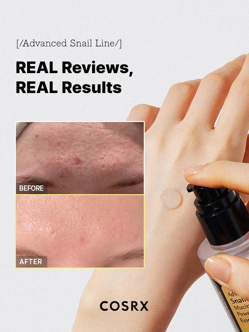COSRX Advanced Snail 96 Mucin Power Essence resultado de uso